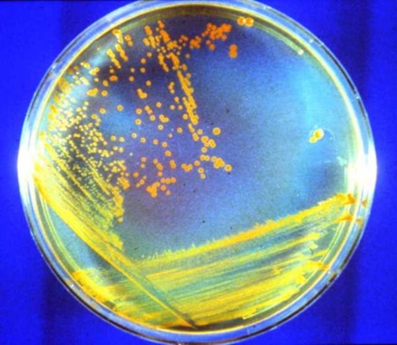 Petri dish with the bacterium Deinococcus radiodurans