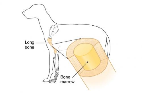 Bone marrow biopsy and examination