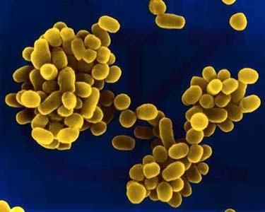 Brucellosis in dogs - symptoms and treatment diseases